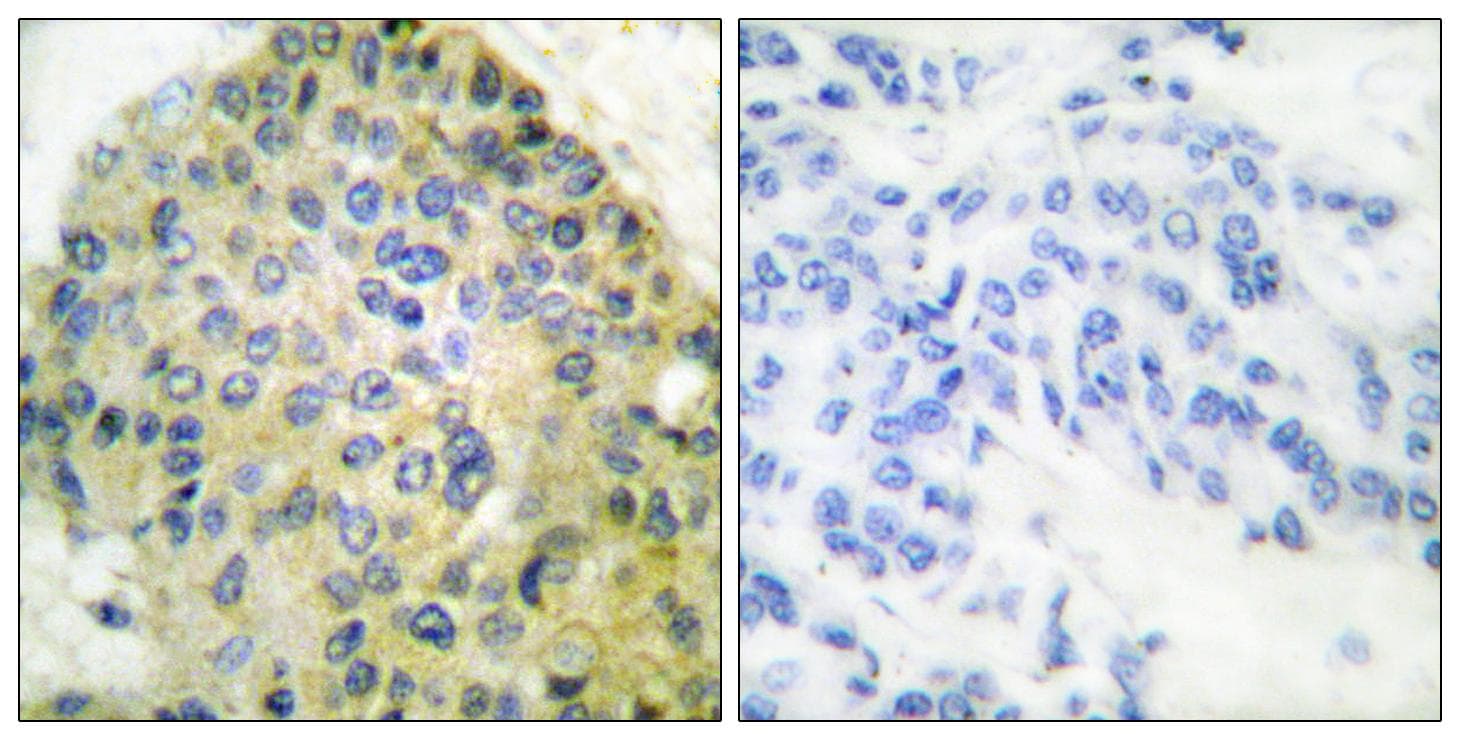 IKBKB / IKK2 / IKK Beta Antibody (p188)