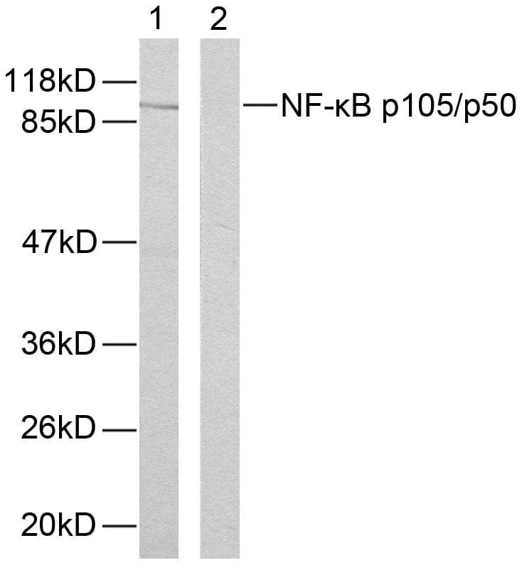Polyclonal Rabbit anti-Human NFKB1 / NF-Kappa-B Antibody (p893, IHC, WB)