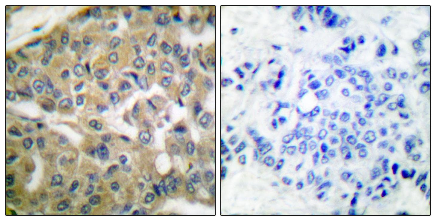Polyclonal Rabbit anti-Human FHIT Antibody (IHC, IF, WB)