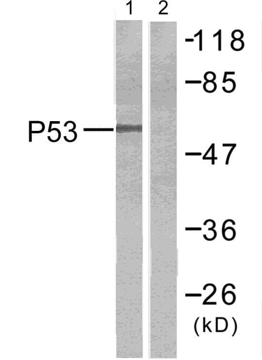 TP53 / p53 Antibody (p9)