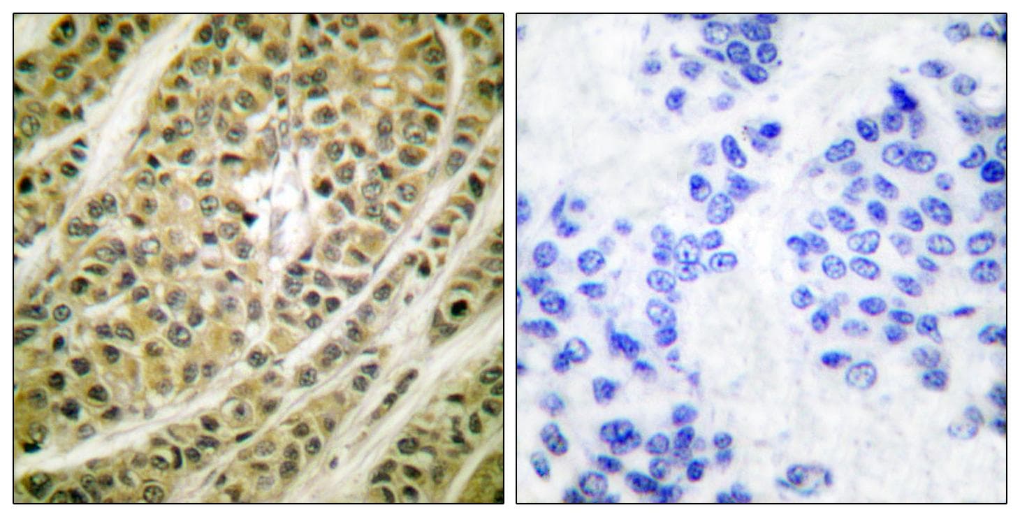 Polyclonal Rabbit anti-Human HDAC5 Antibody (IHC, IF, WB)