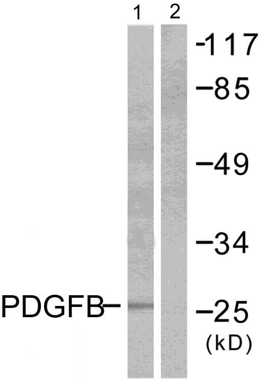 Polyclonal Rabbit anti-Human PDGF-BB Antibody (WB)
