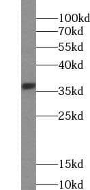 Monoclonal Mouse anti-Human EPCAM Antibody (IHC, WB)