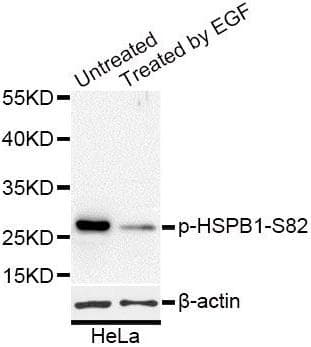 HSPB1 / HSP27 Antibody (phospho-Ser82)