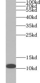 Monoclonal Mouse anti-Human CYCS / Cytochrome c Antibody (IHC, WB)