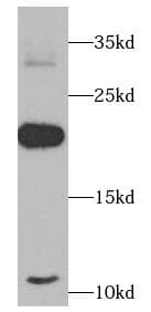 TNF Alpha Antibody