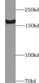 KDR / VEGFR2 / FLK1 Antibody