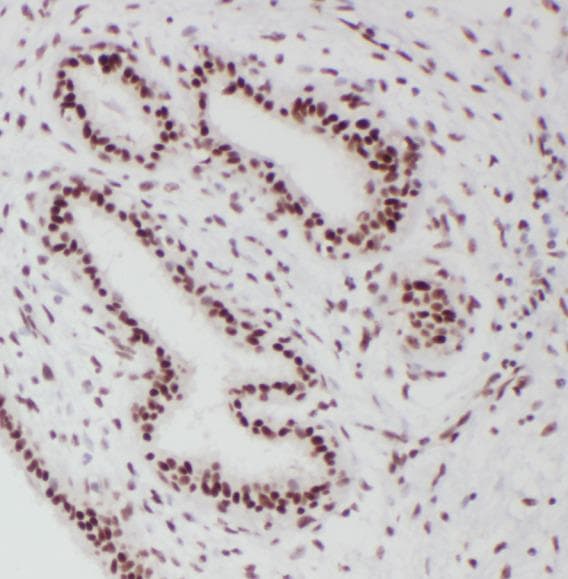 Polyclonal Rabbit anti-Human PR / Progesterone Receptor Antibody (IHC, WB)