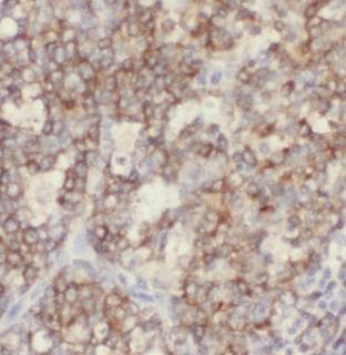 Polyclonal Rabbit anti-Human CR2 / CD21 Antibody (IHC)