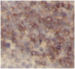Monoclonal Mouse anti-Human CD45 / LCA Antibody (IHC, WB)