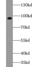 Polyclonal Rabbit anti-Human FGFR2 / FGF Receptor 2 Antibody (phospho-Ser782, WB)