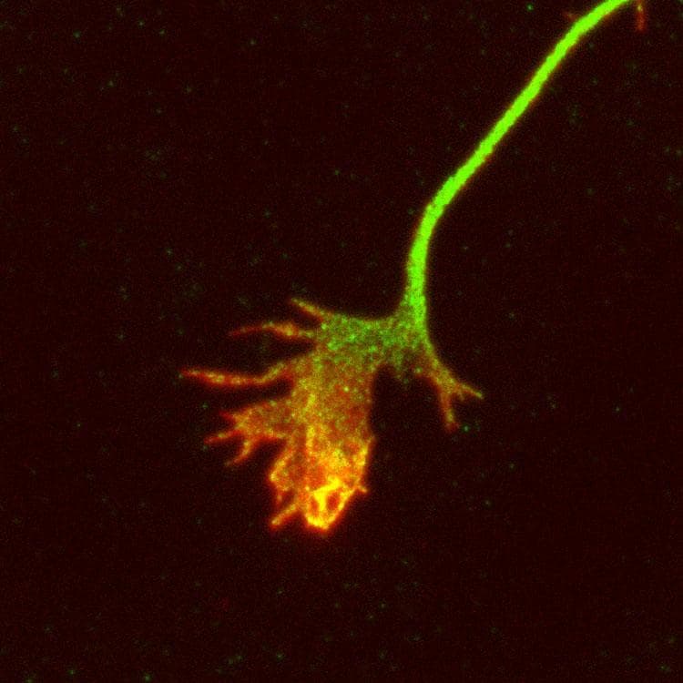 APP / Beta Amyloid Precursor Antibody (aa556-575)