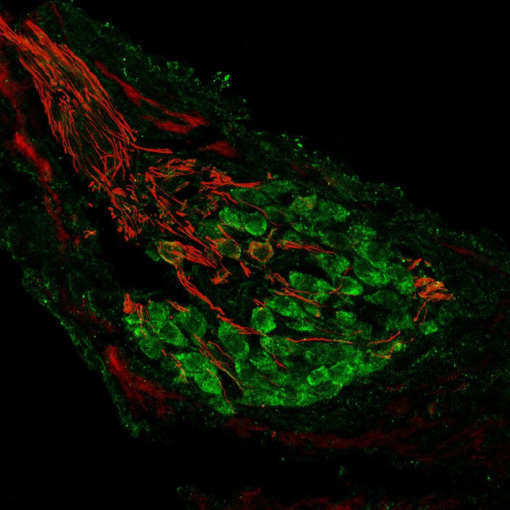 MGLUR2/3 / GLUR2/3 Antibody