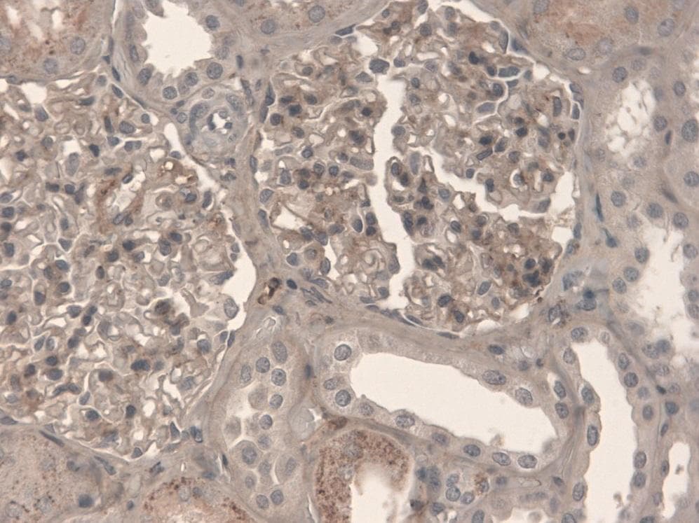 FN1 / Fibronectin Antibody (clone EP5)