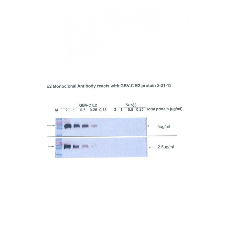 GBV-C E2 Antibody (clone UIE2-1)