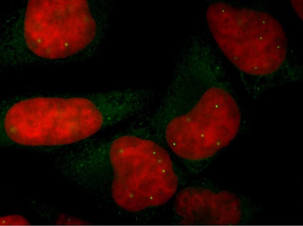 Monoclonal Mouse anti-Human SMN1 Antibody (clone 2B1, IHC, IF, WB)