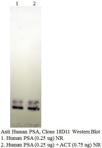 Monoclonal Mouse anti-Human KLK3 / PSA Antibody (clone 18D11-E9B4, WB)