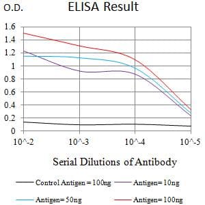 IL21 Receptor Antibody (clone 8H10B4H10)