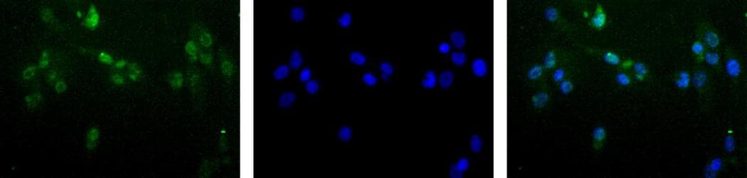 MGMT Antibody (clone MT 23.2)