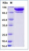 Human Complement C2 Protein (Recombinant His,C-terminus)