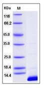 Human S100B / S100 Beta Protein (Recombinant His,N-terminus)