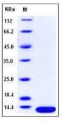 Human B2M / Beta 2 Microglobulin Protein (Recombinant His,C-terminus)