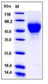 Mouse IL2RA / CD25 Protein (Recombinant His,C-terminus)