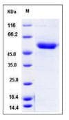 Mouse CD39 Protein (Recombinant His,C-terminus)