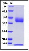 Human CD1B + B2M Heterodimer Protein (Recombinant His,C-terminus)