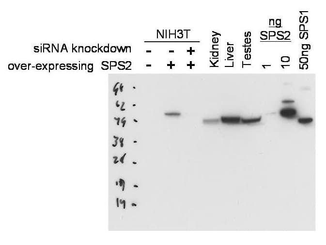 SEPHS2 Antibody