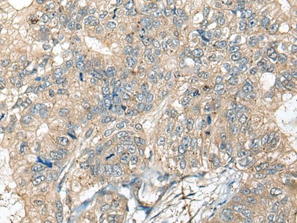Polyclonal Rabbit anti-Human CASR/Calcium Sensing Receptor Antibody (IHC)