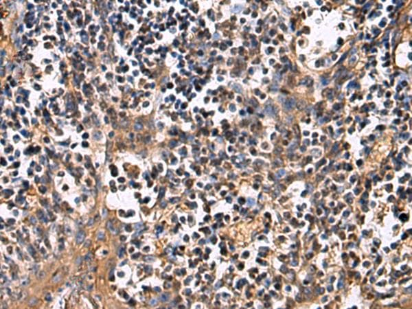 Polyclonal Rabbit anti-Human ECM1 Antibody (aa134-167, IHC, WB)