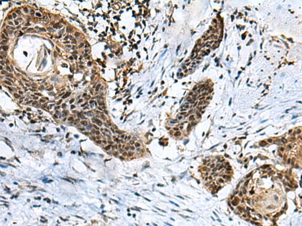 Polyclonal Rabbit anti-Human GLI / GLI1 Antibody (IHC, WB)