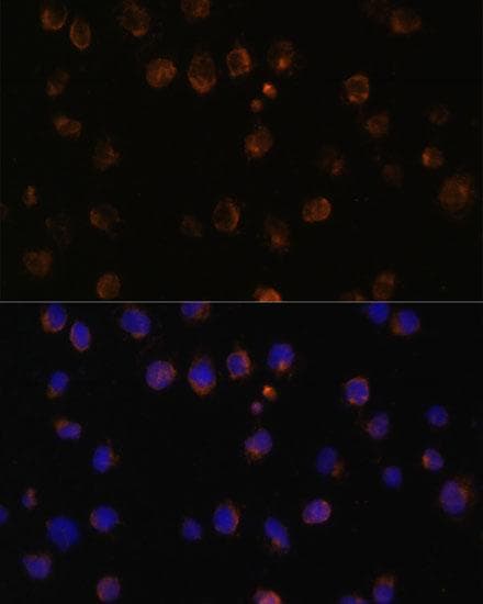 Polyclonal Rabbit anti-Human MYD88 Antibody (IF)
