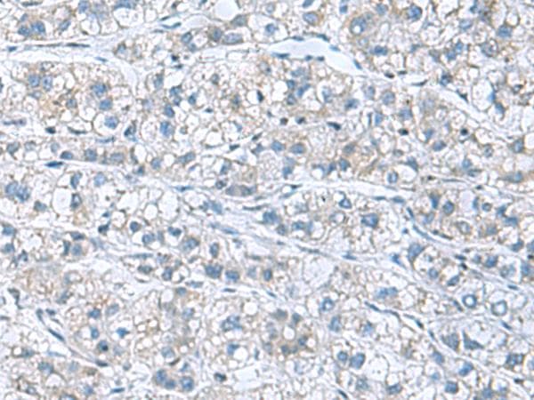 Polyclonal Rabbit anti-Human GDF9 / GDF-9 Antibody (IHC)