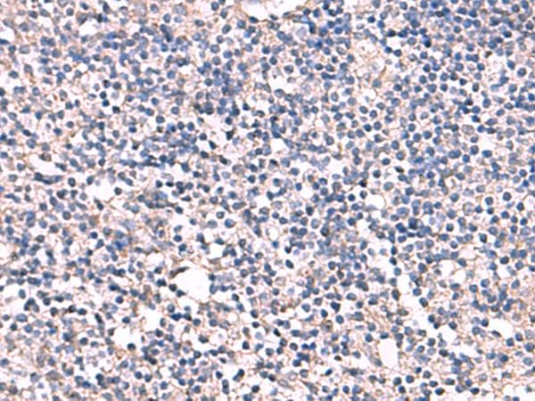 Polyclonal Rabbit anti-Human ESM1 / Endocan Antibody (IHC)