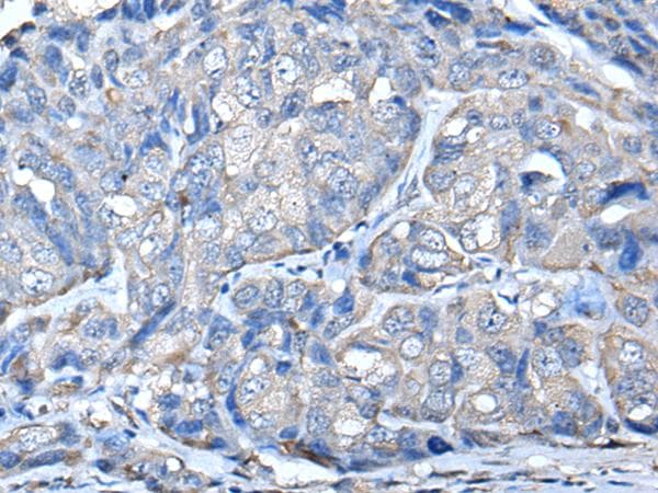 Polyclonal Rabbit anti-Human PRKAR2A Antibody (IHC, WB)