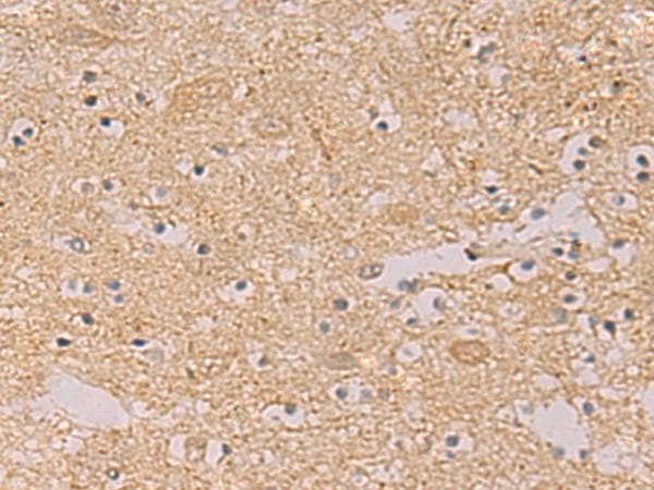 Polyclonal Rabbit anti-Human PTPRN / IA-2 Antibody (IHC)