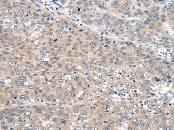 Polyclonal Rabbit anti-Human SEMA4D / Semaphorin 4D / CD100 Antibody (IHC)