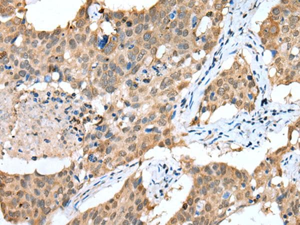 Polyclonal Rabbit anti-Human Sprouty 4 / SPRY4 Antibody (IHC, WB)