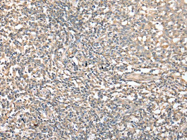 Polyclonal Rabbit anti-Human CD1D Antibody (IHC, WB)