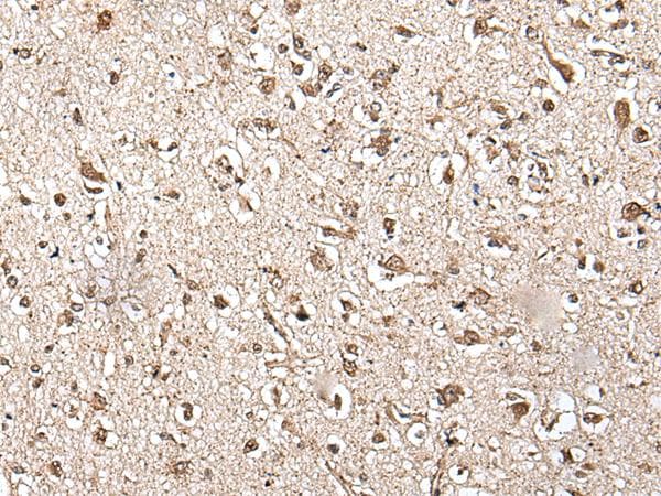 Polyclonal Rabbit anti-Human ZFP36 / Tristetraprolin Antibody (IHC)