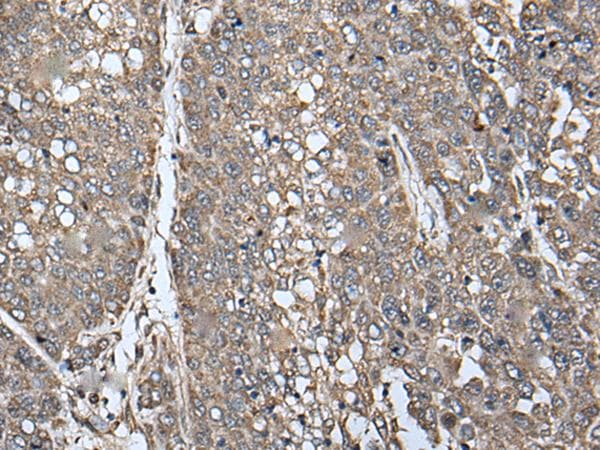 ATAD1 Antibody