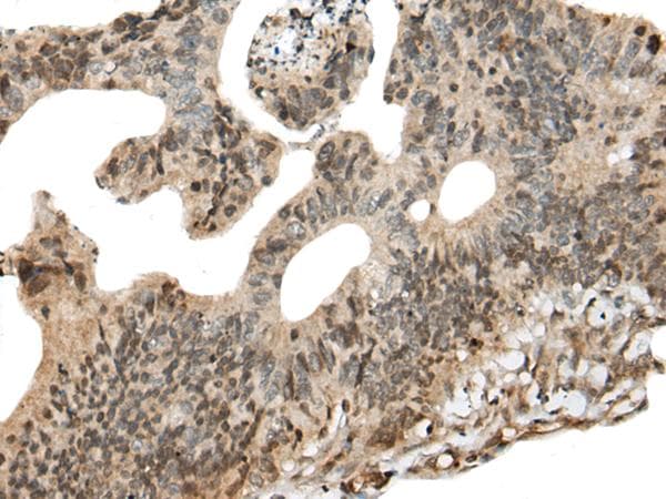 Polyclonal Rabbit anti-Human CALML5 Antibody (IHC)