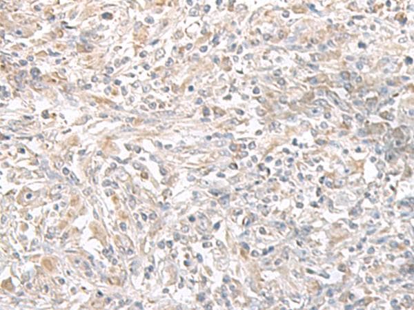 Polyclonal Rabbit anti-Human PFKM / PFK-1 Antibody (IHC)