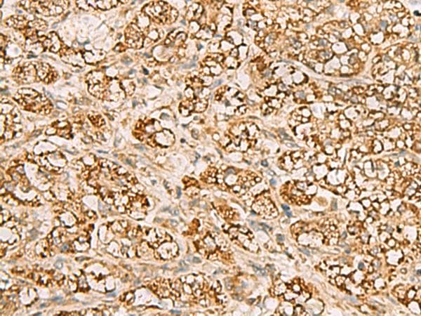 Polyclonal Rabbit anti-Human MTAP Antibody (IHC)