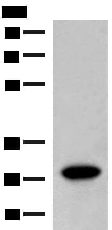Polyclonal Rabbit anti-Human SCGN / Secretagogin Antibody (WB)