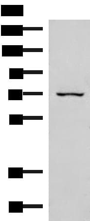 EIF2AK1 Antibody