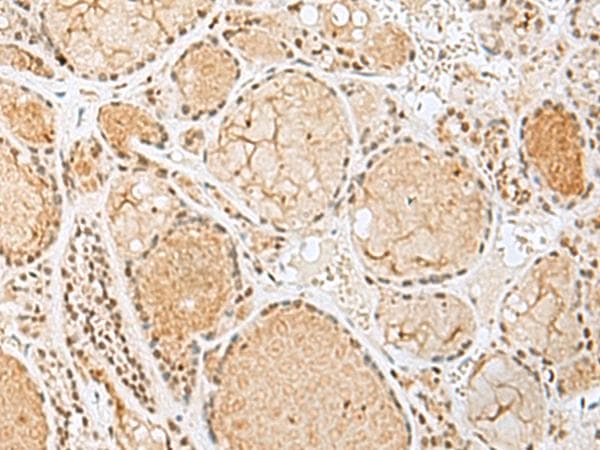 Polyclonal Rabbit anti-Human HIST1H2BN Antibody (IHC)