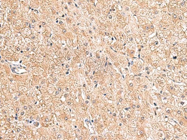 Polyclonal Rabbit anti-Human LRG1 / LRG Antibody (IHC, WB)
